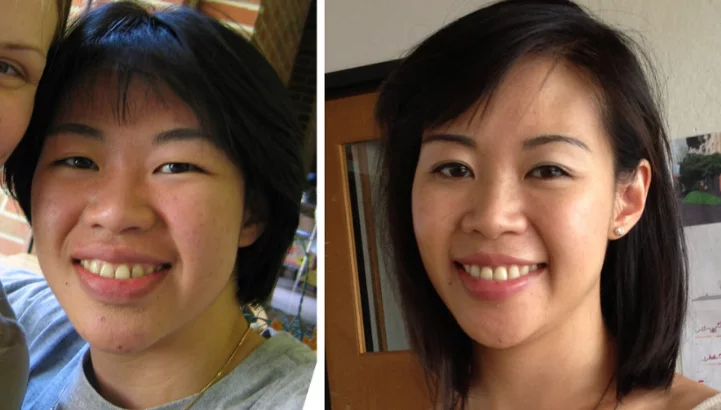 Japanese vs Chinese eyes