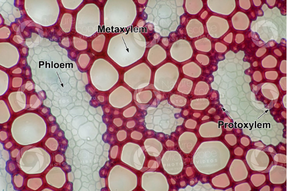 15 Difference Between Protoxylem And Metaxylem (With Pictures) - VIVA ...