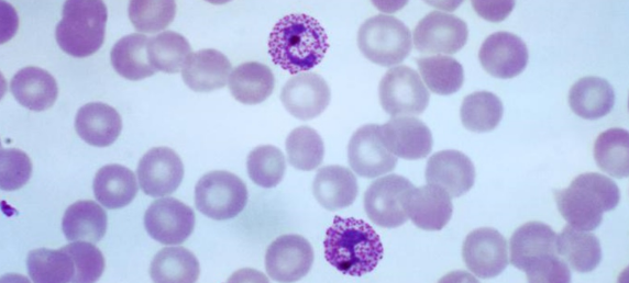 differences-between-plasmodium-vivax-and-falciparum-viva-differences