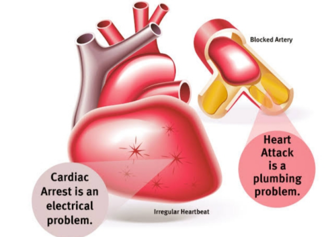 Differences Between Heart Attack And Cardiac Arrest Viva Differences